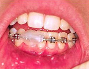 Ortodontide Acil Durumlar