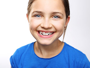 Ortodontik tedaviye başlama yaşı nedir?
